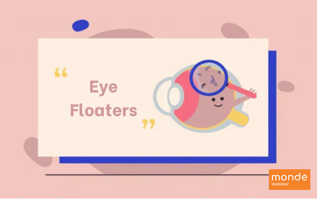 Eye Floaters (Vitreous Degeneration)